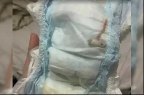 Mariana Sobral denunciou que encontrou um rato morto dentro da fralda